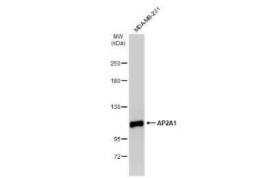 Western Blot: alpha Adaptin Antibody [NBP3-13154] - Whole cell extract (30 ug) was separated by 5% SDS-PAGE, and the membrane was blotted with alpha Adaptin antibody (NBP3-13154) diluted at 1:1000. The HRP-conjugated anti-rabbit IgG antibody (NBP2-19301) was used to detect the primary antibody.