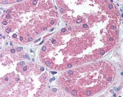 Immunohistochemistry-Paraffin: alpha-Aminoadipate Aminotransferase Antibody [NBP1-02664] - Staining of human kidney. Immunohistochemistry of formalin-fixed, paraffin-embedded tissue after heat-induced antigen retrieval. Antibody concentration 5 ug/ml.