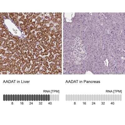 Immunohistochemistry-Paraffin: alpha-Aminoadipate Aminotransferase Antibody [NBP1-89627] - Staining in human liver and pancreas tissues using anti-AADAT antibody. Corresponding AADAT RNA-seq data are presented for the same tissues.