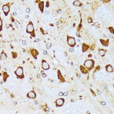 Immunohistochemistry-Paraffin: alpha COP I Antibody (3W6Y6) [NBP3-15839] - Immunohistochemistry of paraffin-embedded rat brain using alpha COP I Rabbit mAb (NBP3-15839) at dilution of 1:100 (40x lens).Perform microwave antigen retrieval with 10 mM Tris/EDTA buffer pH 9.0 before commencing with IHC staining protocol.