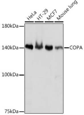 Western Blot: alpha COP I Antibody (3W6Y6) [NBP3-15839] - Western blot analysis of extracts of various cell lines, using alpha COP I Rabbit mAb (NBP3-15839) at 1:1000 dilution. Secondary antibody: HRP Goat Anti-Rabbit IgG (H+L) at 1:10000 dilution. Lysates/proteins: 25ug per lane. Blocking buffer: 3% nonfat dry milk in TBST. Detection: ECL Basic Kit. Exposure time: 1s.