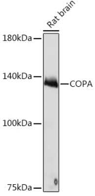 Western Blot: alpha COP I Antibody (3W6Y6) [NBP3-15839] - Western blot analysis of extracts of Rat brain, using alpha COP I Rabbit mAb (NBP3-15839) at 1:1000 dilution. Secondary antibody: HRP Goat Anti-Rabbit IgG (H+L) at 1:10000 dilution. Lysates/proteins: 25ug per lane. Blocking buffer: 3% nonfat dry milk in TBST. Detection: ECL Basic Kit. Exposure time: 10s.