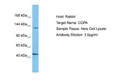 Western Blot: alpha COP I Antibody [NBP1-59297] - Hela Whole Cell lysates, Antibody Dilution: 3 ug/ml.