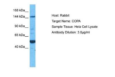 Western Blot: alpha COP I Antibody [NBP1-59297] - Hela Whole Cell lysates, Antibody Dilution: 3.0 ug/ml.