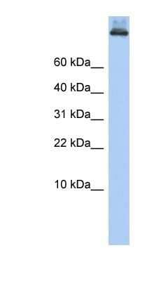 Western Blot: alpha COP I Antibody [NBP1-59298] - Titration: 0.2-1 ug/ml, Positive Control: 721_B cell lysate.