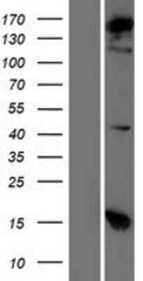 Western Blot: alpha COP I Overexpression Lysate (Adult Normal) [NBP2-10923] Left-Empty vector transfected control cell lysate (HEK293 cell lysate); Right -Over-expression Lysate for alpha COP I.