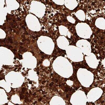 Immunohistochemistry: alpha-Defensin 1 Antibody [NBP2-46808] - Staining of human bone marrow shows strong cytoplasmic positivity in hematopoietic cells.