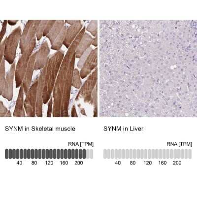 Immunohistochemistry-Paraffin: alpha Desmuslin Antibody [NBP2-37892] - Analysis in human skeletal muscle and liver tissues using NBP2-37892 antibody. Corresponding SYNM RNA-seq data are presented for the same tissues.