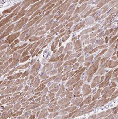 Immunohistochemistry-Paraffin: alpha Desmuslin Antibody [NBP2-37892] - Staining of human heart muscle shows strong cytoplasmic positivity in cardiomyocytes.