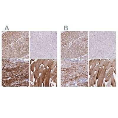 <b>Independent Antibodies Validation and Orthogonal Strategies Validation.</b>Immunohistochemistry-Paraffin: alpha Desmuslin Antibody [NBP2-37892] - Staining of human heart muscle, liver, prostate and skeletal muscle using Anti-SYNM antibody NBP2-37892 (A) shows similar protein distribution across tissues to independent antibody NBP2-37909 (B).