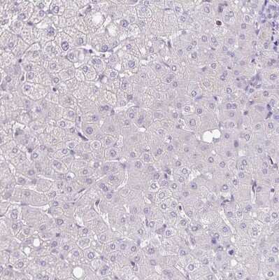 Immunohistochemistry-Paraffin: alpha Desmuslin Antibody [NBP2-37892] - Staining of human liver shows no cytoplasmic positivity in hepatocytes.