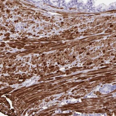 Immunohistochemistry-Paraffin: alpha Desmuslin Antibody [NBP2-37892] - Staining of human prostate shows strong cytoplasmic positivity in smooth muscle cells.