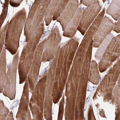 Immunohistochemistry-Paraffin: alpha Desmuslin Antibody [NBP2-37892] - Staining of human skeletal muscle shows strong cytoplasmic positivity in myocytes.