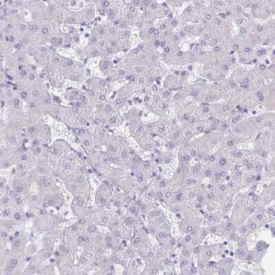 Immunohistochemistry-Paraffin: alpha Desmuslin Antibody [NBP2-37909] - Staining of human liver shows low expression as expected.