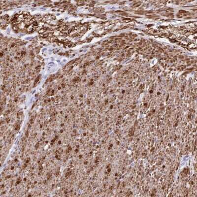 Immunohistochemistry-Paraffin: alpha Desmuslin Antibody [NBP2-37909] - Staining of human smooth muscle shows high expression.