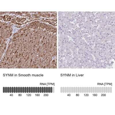 <b>Orthogonal Strategies Validation. </b>Immunohistochemistry-Paraffin: alpha Desmuslin Antibody [NBP2-37909] - Staining in human smooth muscle and liver tissues using anti-SYNM antibody. Corresponding SYNM RNA-seq data are presented for the same tissues.