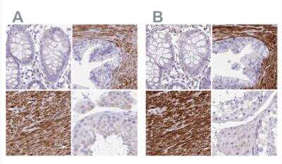 <b>Independent Antibodies Validation. </b>Immunohistochemistry-Paraffin: alpha Desmuslin Antibody [NBP2-37909] - Staining of human colon, prostate, smooth muscle and testis using Anti-SYNM antibody NBP2-37909 (A) shows similar protein distribution across tissues to independent antibody NBP2-37892 (B).