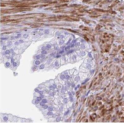 Immunohistochemistry-Paraffin: alpha Desmuslin Antibody [NBP2-37909] - Staining of human prostate using Anti-SYNM antibody.