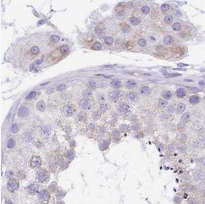 Immunohistochemistry-Paraffin: alpha Desmuslin Antibody [NBP2-37909] - Staining of human testis using Anti-SYNM antibody.