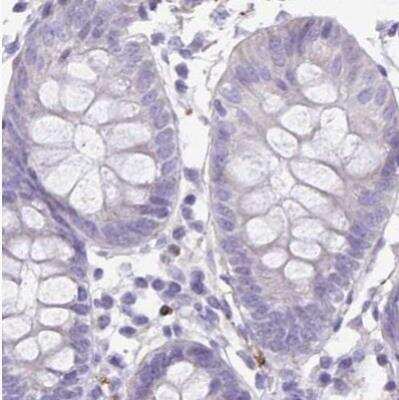 Immunohistochemistry-Paraffin: alpha Desmuslin Antibody [NBP2-37909] - Staining of human colon using Anti-SYNM antibody.