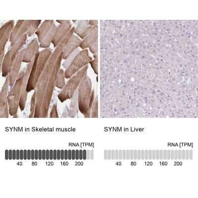 Immunohistochemistry-Paraffin: alpha Desmuslin Antibody [NBP2-37909] - Analysis in human skeletal muscle and liver tissues using NBP2-37909 antibody. Corresponding SYNM RNA-seq data are presented for the same tissues.