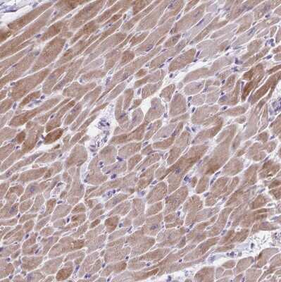 Immunohistochemistry-Paraffin: alpha Desmuslin Antibody [NBP2-37909] - Staining of human heart muscle shows strong cytoplasmic positivity in cardiomyocytes.