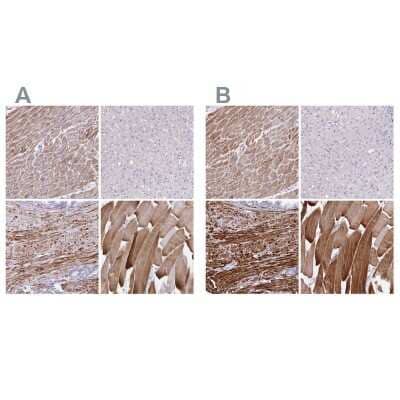 Immunohistochemistry-Paraffin: alpha Desmuslin Antibody [NBP2-37909] - Staining of human heart muscle, liver, prostate and skeletal muscle using Anti-SYNM antibody NBP2-37909 (A) shows similar protein distribution across tissues to independent antibody NBP2-37892 (B).