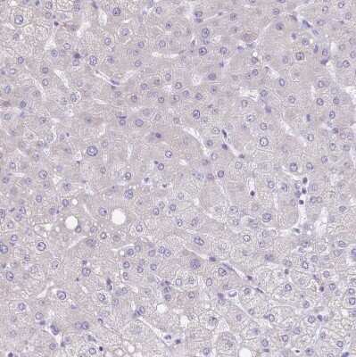 Immunohistochemistry-Paraffin: alpha Desmuslin Antibody [NBP2-37909] - Staining of human liver shows no cytoplasmic positivity in hepatocytes.