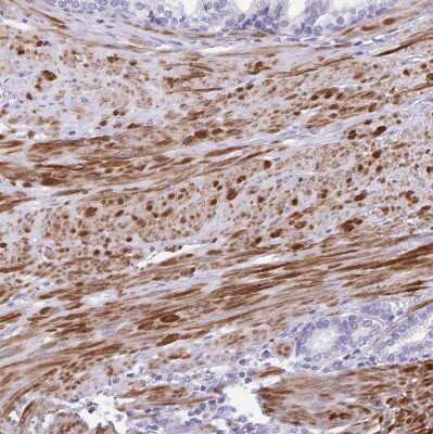 Immunohistochemistry-Paraffin: alpha Desmuslin Antibody [NBP2-37909] - Staining of human prostate shows strong cytoplasmic positivity in smooth muscle cells.