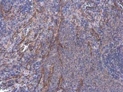 Immunohistochemistry-Paraffin: alpha Desmuslin Antibody [NBP3-13366] - alpha Desmuslin antibody detects alpha Desmuslin protein by immunohistochemical analysis. Sample: Paraffin-embedded rat spleen. alpha Desmuslin stained by alpha Desmuslin antibody (NBP3-13366) diluted at 1:500. Antigen Retrieval: Citrate buffer, pH 6.0, 15 min