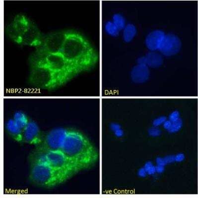 Immunocytochemistry/Immunofluorescence: alpha-Fetoprotein/AFP Antibody (AF5) [NBP2-82221] - Immunofluorescence analysis of paraformaldehyde fixed HepG2 cells, permeabilized with 0.15% Triton stained with the chimeric rabbit IgG version of alpha-Fetoprotein/AFP Antibody (AF5) [NBP2-82221] at 10 ug/ml for 1h followed by Alexa Fluor 488 secondary antibody (1 ug/ml), showing cytoplasmic staining. The nuclear stain is DAPI (blue). Panels show from left-right, top-bottom: NBP2-82221, DAPI, merged channels and a negative control. The negative control was stained with unimmunized rabbit IgG followed by Alexa Fluor 488 secondary antibody.
