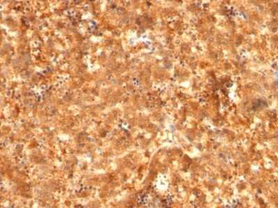 Immunohistochemistry-Paraffin: alpha-Fetoprotein/AFP Antibody (C2 + C3 + MBS-12) - Azide and BSA Free [NBP2-48013] - Human Fetal Liver stained with AFP Monoclonal Antibody (C2 + C3 + MBS-12).