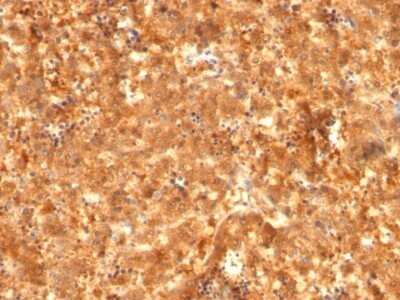 Immunohistochemistry-Paraffin: alpha-Fetoprotein/AFP Antibody (C2 + C3 + MBS-12) - IHC-Prediluted [NBP2-48111] - Human Fetal Liver stained with AFP Monoclonal Antibody (C2 + C3 + MBS-12).