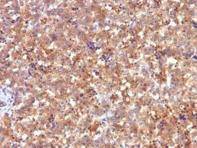 Immunohistochemistry-Paraffin: alpha-Fetoprotein/AFP Antibody (C2) - Azide and BSA Free [NBP2-48016] - Human Fetal Liver stained with AFP Monoclonal Antibody (C2).