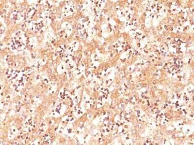 Immunohistochemistry-Paraffin: alpha-Fetoprotein/AFP Antibody (C3) - Azide and BSA Free [NBP2-34577] - Formalin-fixed, paraffin-embedded human fetal liver stained with AFP MAb (C3).