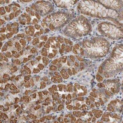 Immunohistochemistry: alpha-Fetoprotein/AFP Antibody [NBP2-80483] - Immunohistochemical staining of human stomach shows distinct cytoplasmic positivity in glandular cells.