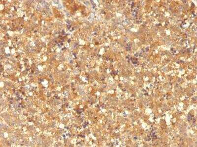 Immunohistochemistry-Paraffin: alpha-Fetoprotein/AFP Antibody (MBS-12) - IHC-Prediluted [NBP2-48120] - Human Fetal Liver stained with AFP Mouse Monoclonal Antibody (MBS-12).