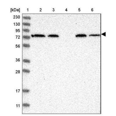 Western Blot: alpha-Fetoprotein/AFP Antibody [NBP2-80483] - Lane 1: Marker [kDa] 230, 130, 95, 72, 56, 36, 28, 17, 11Lane 2: Human cell line RT-4Lane 3: Human cell line U-251MG spLane 4: Human plasma (IgG/HSA depleted)Lane 5: Human liver tissueLane 6: Human tonsil tissue