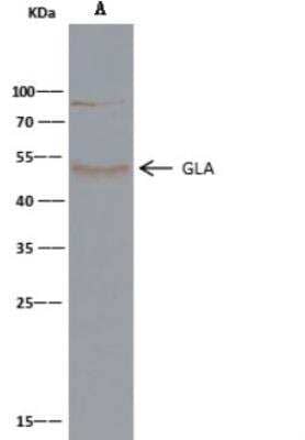 Immunoprecipitation: alpha-Galactosidase A/GLA Antibody (001) [NBP2-90047] - Lane A:0.5 mg MCF-7 Whole Cell Lysate2 uL anti-GLA rabbit monoclonal antibody and 15 ul of 50 % Protein G agarose.Primary antibody:Anti-GLA rabbit monoclonal antibody,at 1:1000 dilution Secondary antibody:Clean-Bloto IP Detection Reagent (HRP) at 1:1000 dilution Developed using the DAB staining technique.Performed under reducing conditions.Predicted band size: 49 kDaObserved band size: 52 kDa