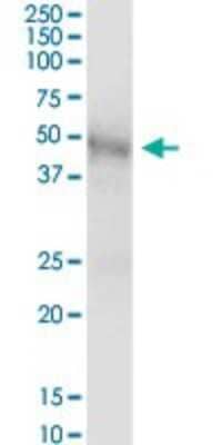 Western Blot: alpha-Galactosidase A/GLA Antibody [H00002717-B01P] - Analysis of GLA expression in human kidney.