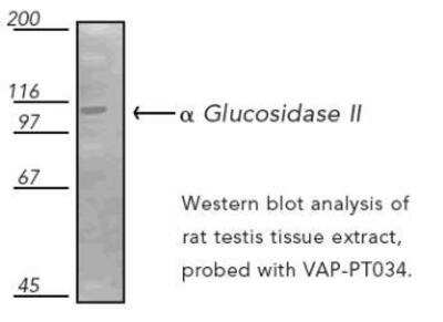 Western Blot: alpha Glucosidase 2 Antibody [NBP1-19336] - Western blot analysis of rat testis tissue extract probed with VAP-PT034