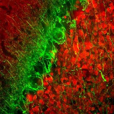 Immunohistochemistry Free-Floating: alpha-Internexin Antibody (1D2) [NB300-216] - Analysis of rat cerebellum section stained with alpha-internexin antibody, dilution 1:5,000 (Green), and costained with chicken Calretinin pAb,  dilution 1:2,000 (Red). Following transcardial perfusion of rat with 4% paraformaldehyde, brain was post fixed for 24hrs, cut to 45uM, and free-floating sections were stained with the above antibodies. The alpha-internexin antibody selectively stains neuronal processes, in particular parallel fibers, the axons of granule cells. Calretinin antibody stains interneurons predominantly in the molecular layer of the cerebellum.