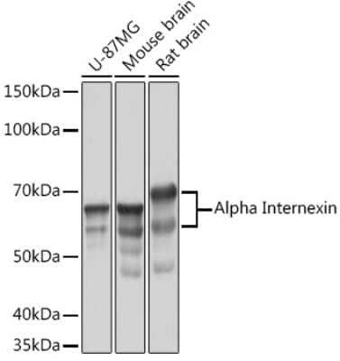 Western Blot: alpha-Internexin Antibody (5E5Z3) [NBP3-16230] - Western blot analysis of extracts of various cell lines, using alpha-Internexin Rabbit mAb (NBP3-16230) at 1:1000 dilution. Secondary antibody: HRP Goat Anti-Rabbit IgG (H+L) at 1:10000 dilution. Lysates/proteins: 25ug per lane. Blocking buffer: 3% nonfat dry milk in TBST. Detection: ECL Basic Kit. Exposure time: 5s.