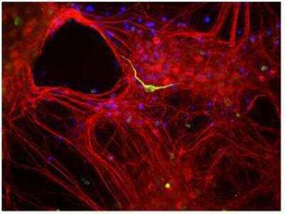 Immunocytochemistry/Immunofluorescence: alpha Internexin Antibody [NB300-139] - Mixed neuron-glial cultures stained with rabbit antibody to alpha-internexin (red) and chicken antibody to peripherin CPCA-Peri (green). The alpha internexin antibody stains numerous axonal and dendritic profiles in these cultures, while peripherin antibody binds to only a subset of neurons.