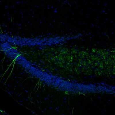 Immunohistochemistry-Paraffin alpha-Internexin Antibody - BSA Free