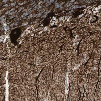 Immunohistochemistry-Paraffin alpha-Internexin Antibody - BSA Free