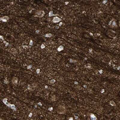 Immunohistochemistry-Paraffin alpha-Internexin Antibody - BSA Free