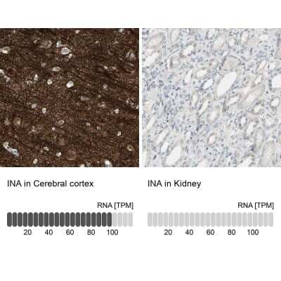 Immunohistochemistry-Paraffin alpha-Internexin Antibody - BSA Free