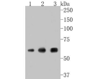 Western Blot: alpha-Internexin Antibody (JU25-03) [NBP2-75407] - Western blot analysis of alpha-Internexin on different lysates. Proteins were transferred to a PVDF membrane and blocked with 5% BSA in PBS for 1 hour at room temperature. The primary antibody (1/500) was used in 5% BSA at room temperature for 2 hours. Goat Anti-Rabbit IgG - HRP Secondary Antibody (HA1001) at 1:5,000 dilution was used for 1 hour at room temperature. Positive control: Lane 2: A549 cell lysate Lane 1: mouse brain tissue lysate Lane 2: PC-12 cell lysate