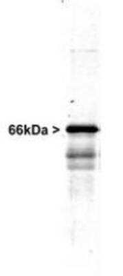 Western Blot: alpha Internexin Antibody [NB300-139] - Western blot of whole rat spinal cord homogenate stained with RPCA-a-Int, at dilution of 1:20,000. A prominent band running at ~66kDa is apparent, as well as smaller lower bands which are apparently degradation products. A minor band at ~150kDa is also seen, apparently resulting from dimerization of alpha-internexin.